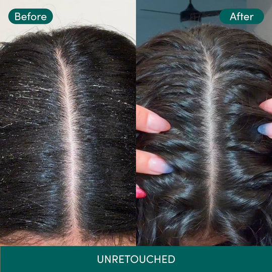 Clarifying Detox Shampoo - alternate view